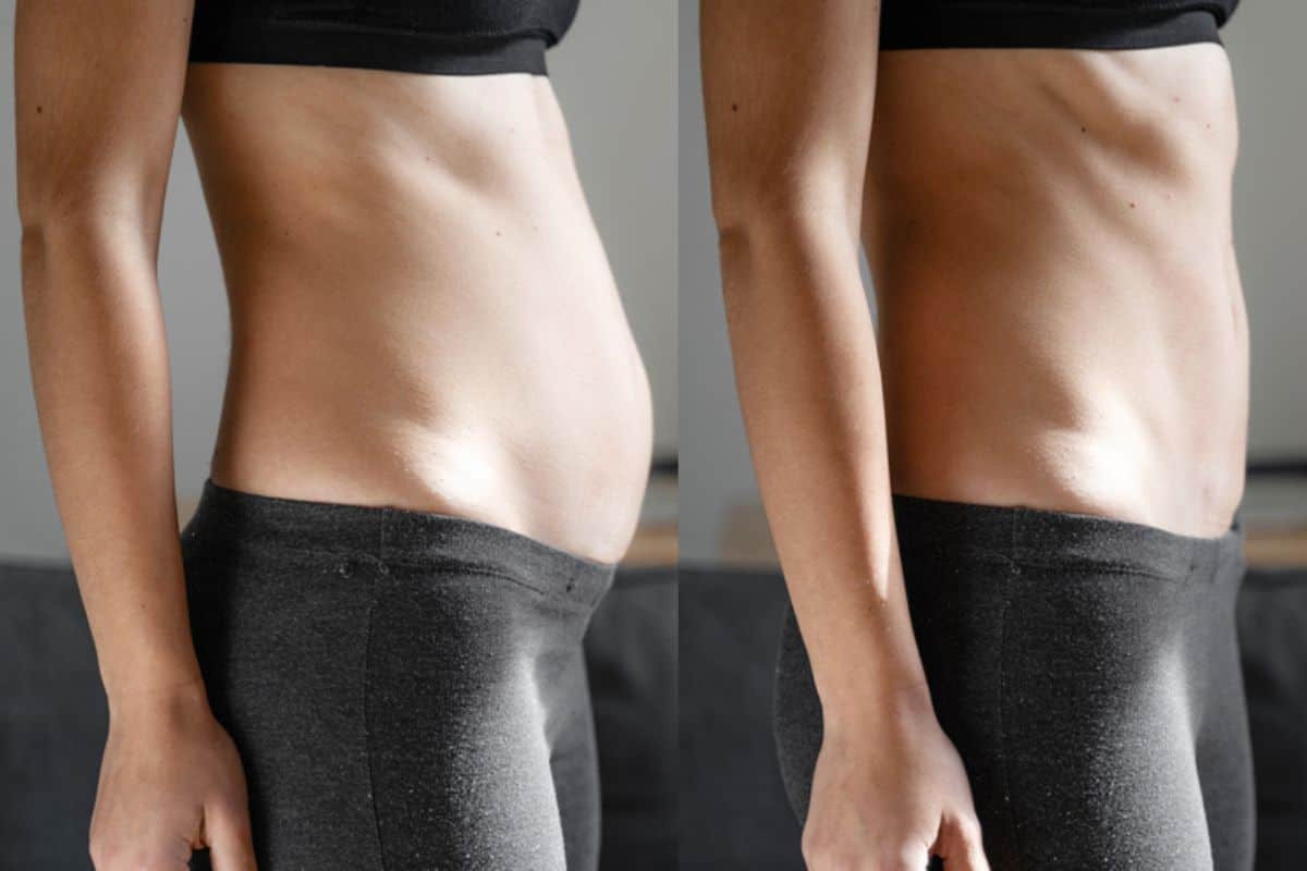 Post-Pregnancy: What Happens to Your Abdominal Muscles After Birth Accrington