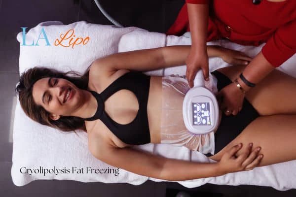 woman getting cryolipolysis Accrington