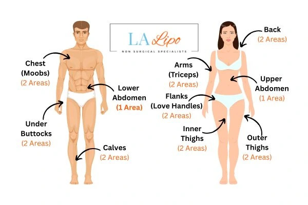 LA LIPO Cryolipolysis Areas Accrington