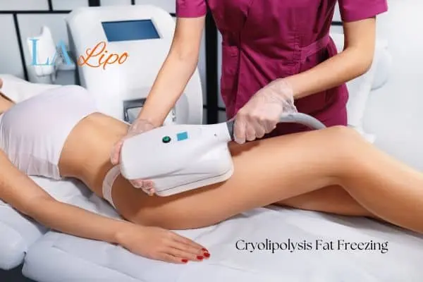 Woman receiving coolsculpting Accrington treatment on her thighs