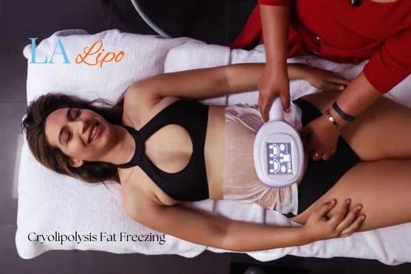 woman getting cryolipolysis Accrington