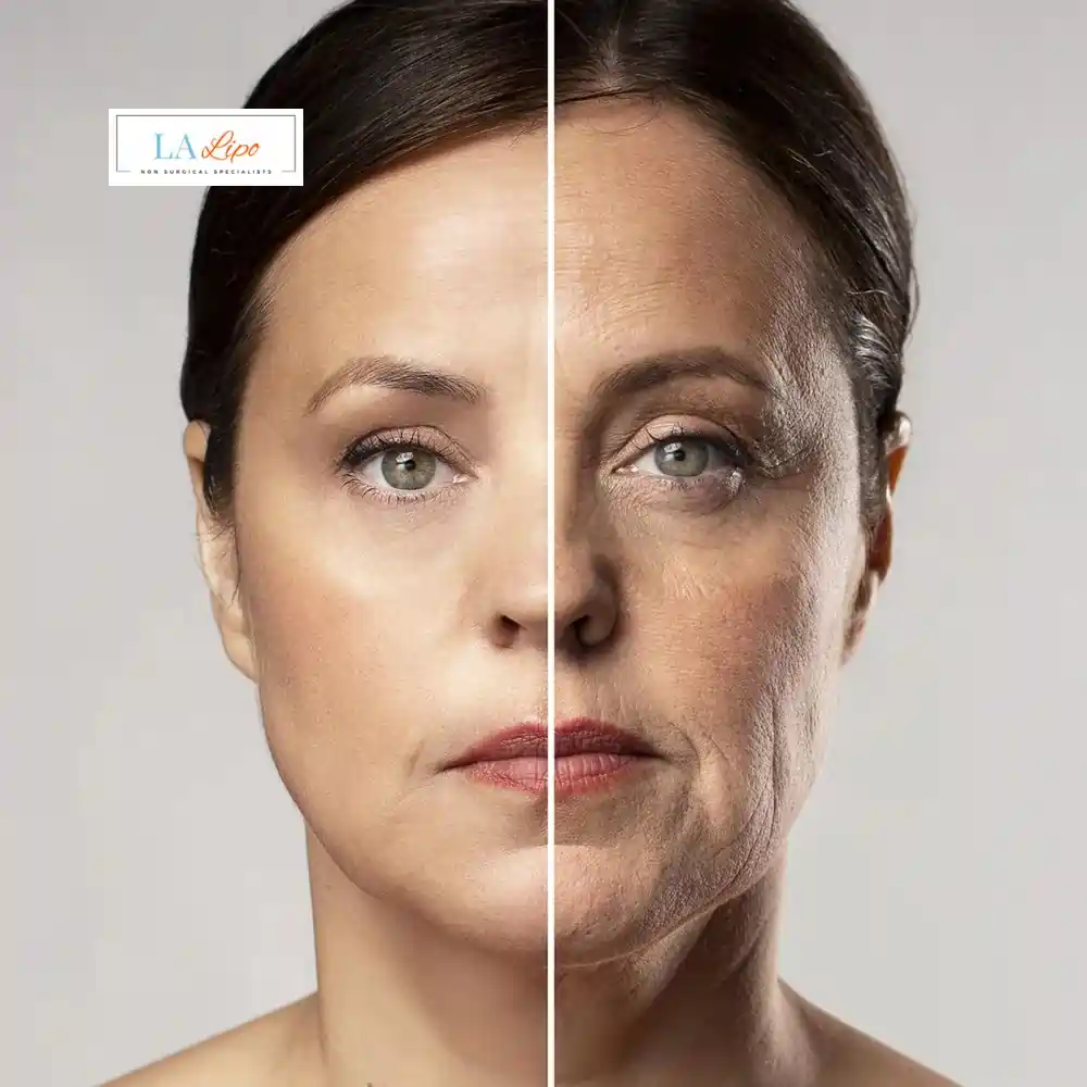 How Can You Tell If Non-Surgical Skin Tightening Is Right for You Accrington?
