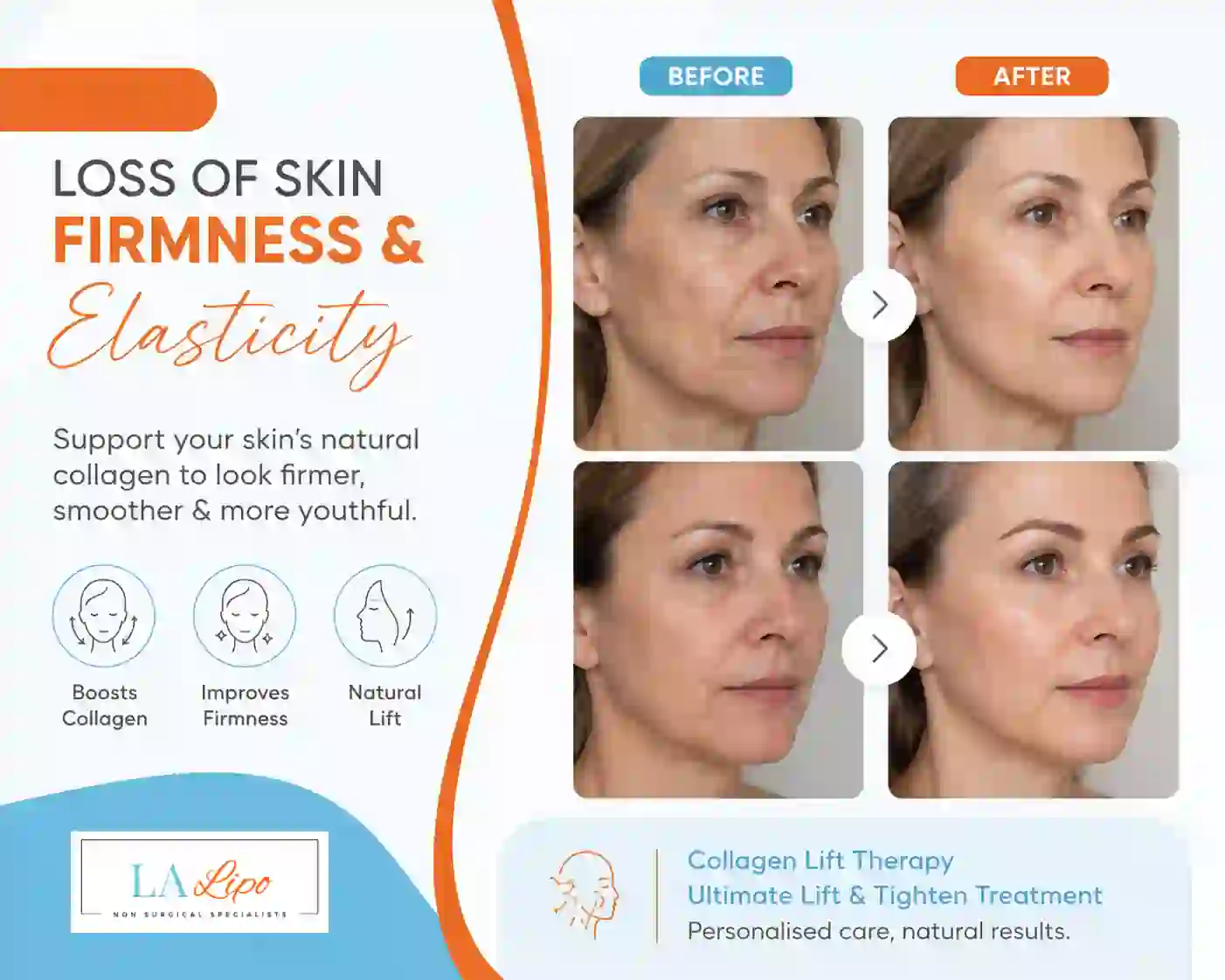Sign #7: Loss of Skin Firmness and Elasticity Accrington